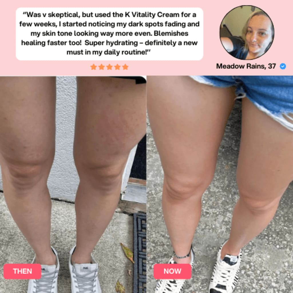 Cellulite Relief