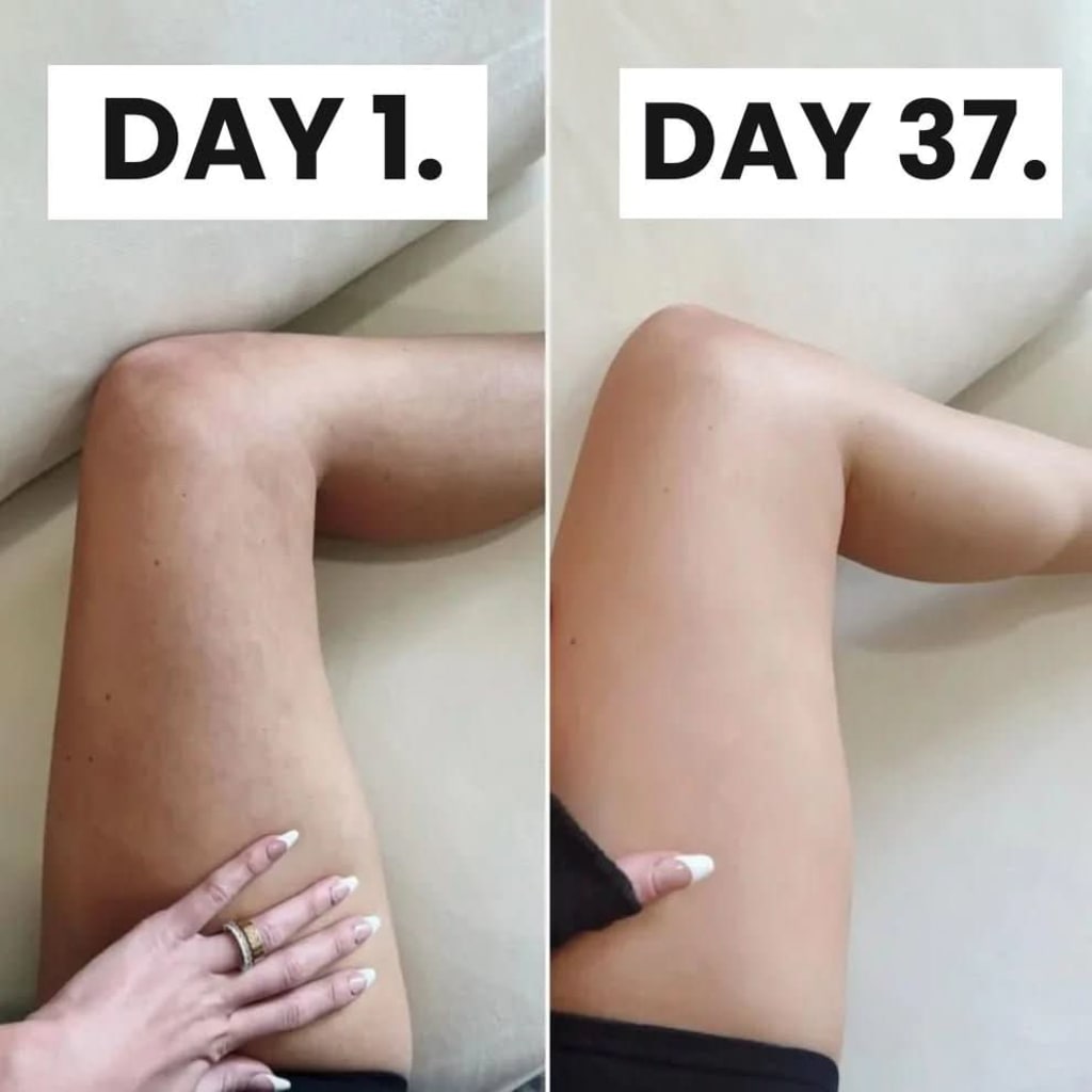 Cellulite Relief
