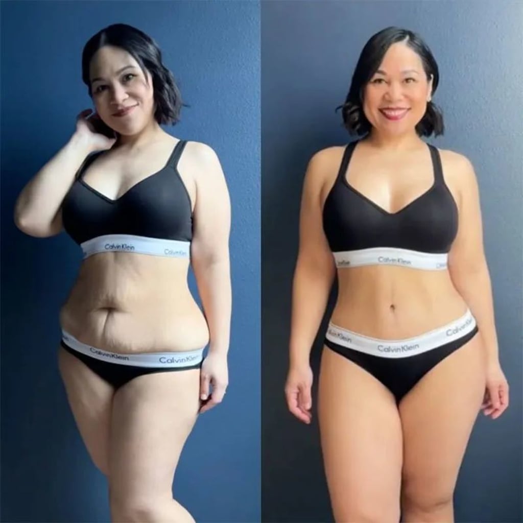 Cellulite Relief