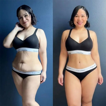 Cellulite Relief