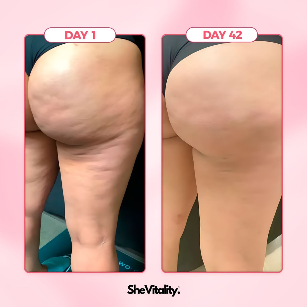Cellulite Relief